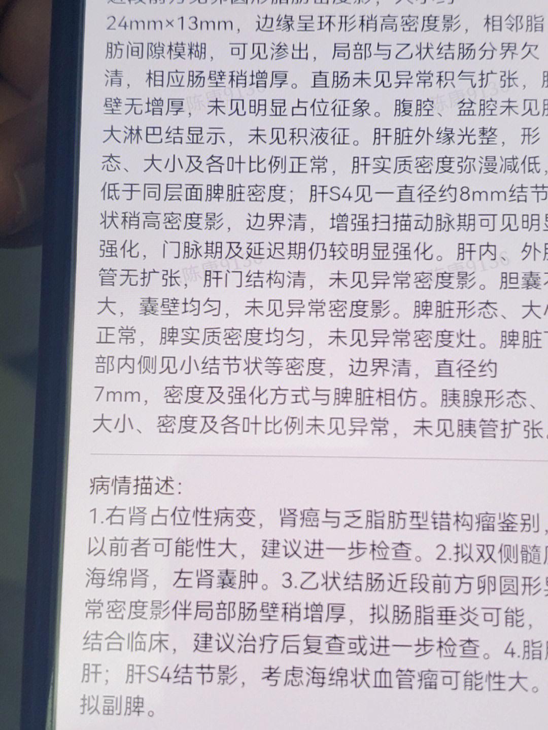 “肾”里没“事”，为何“转移”成难题？