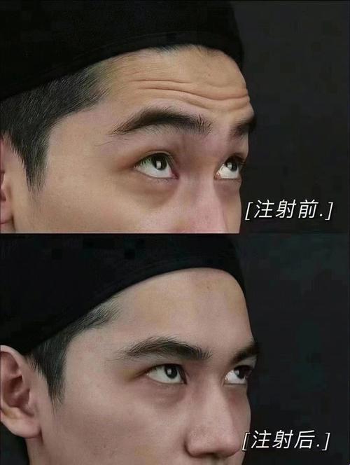 男仕除皱，谁与争锋？