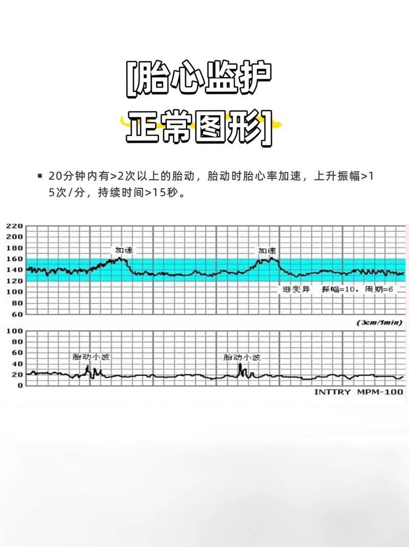 胎心监护从150降到120，胎儿的“心”跳是不是在打“盹”？