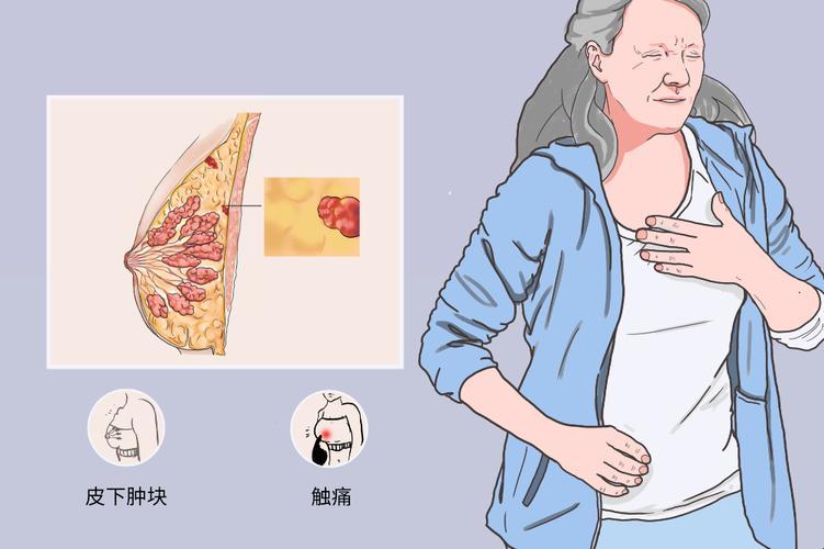 “乳”不由衷：粉红陷阱里的笑与泪