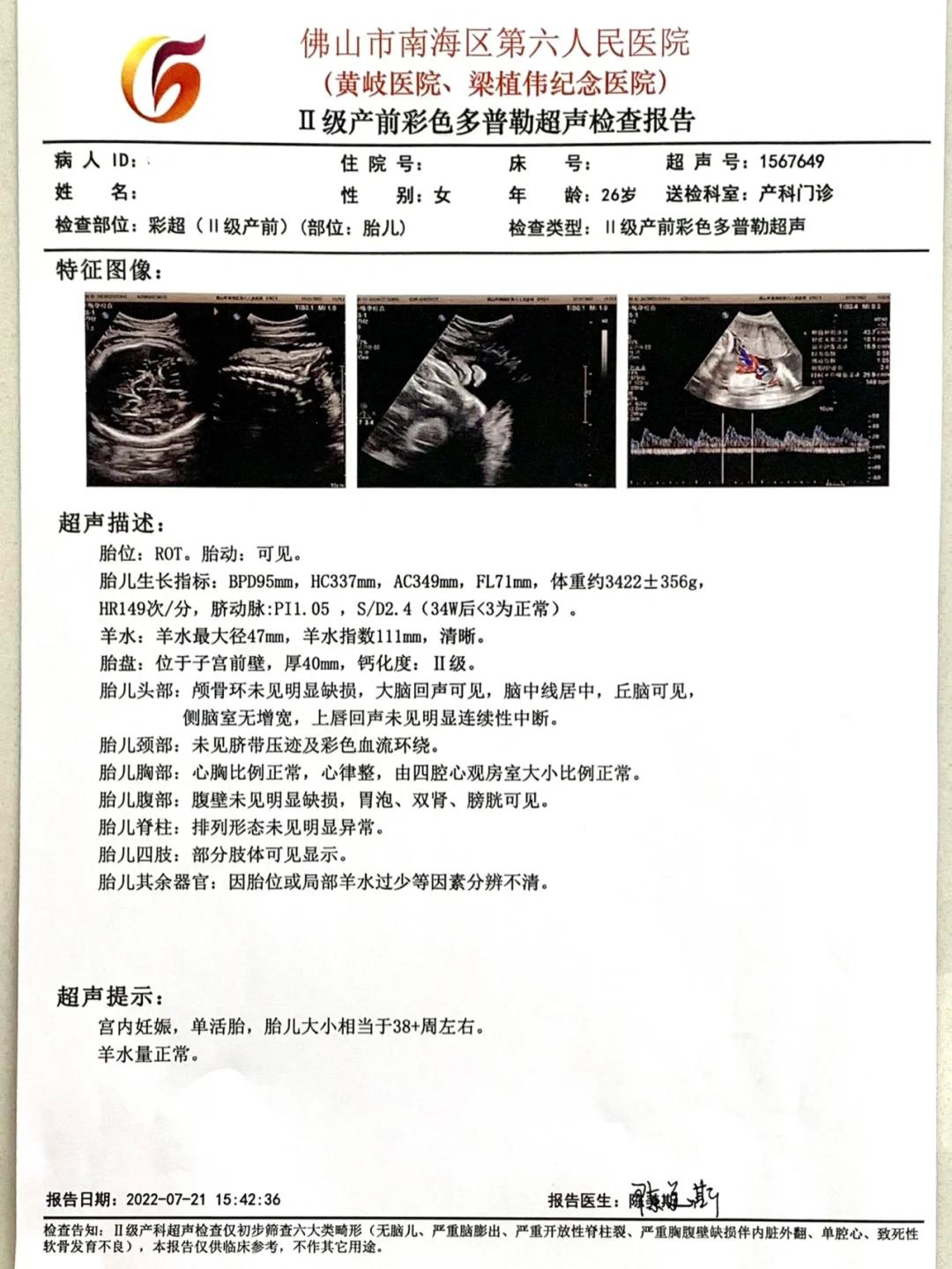 38周，宝宝说：地球，我来了！