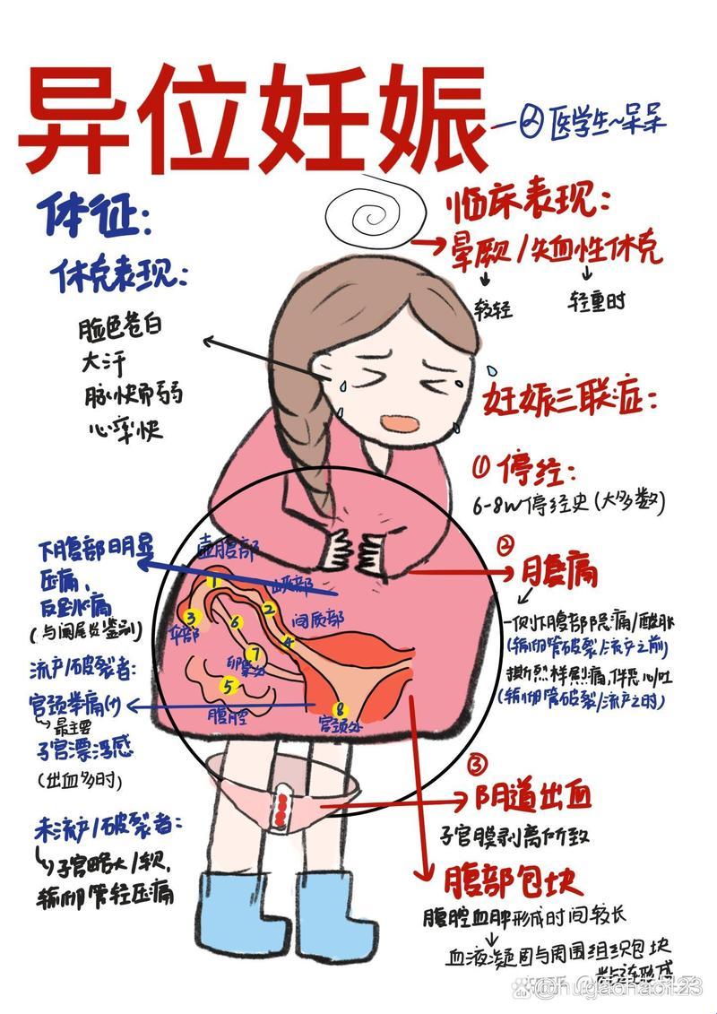 宫外孕，又怎样？炸裂人生不等闲！