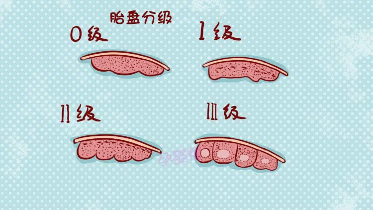 23周胎盘1级，滋补过头还是幽默过头？