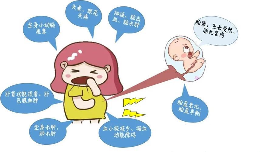 “子痫”风波：妈妈受罪，谁在偷笑？