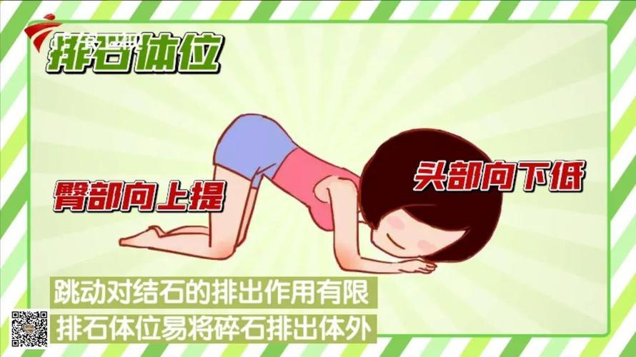 肾结石运动记：痛并快乐着