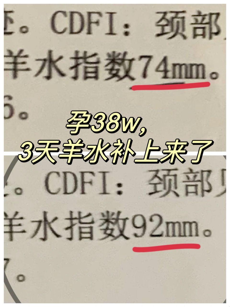 38周羊水少，还能浪得起来吗？