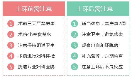 上环这点事儿：玩转注意事项，保养也疯狂