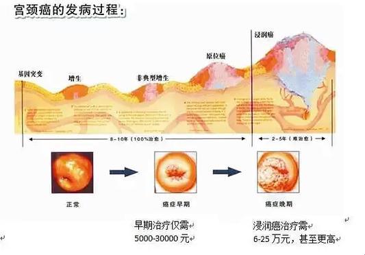 肿瘤浸润，可不是闹着玩的“散步”！