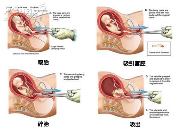 7月胎动，笑谈痛与不痛，谁解其中味？