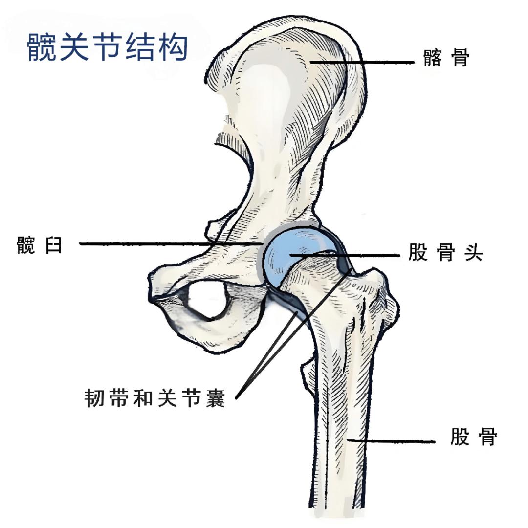 屁股角落里的髋关节：幽默自嘲探索