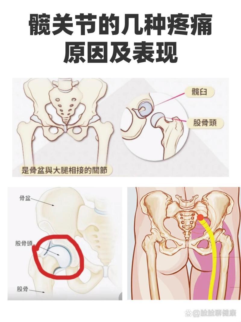 胯骨错位，疼痛的双关语