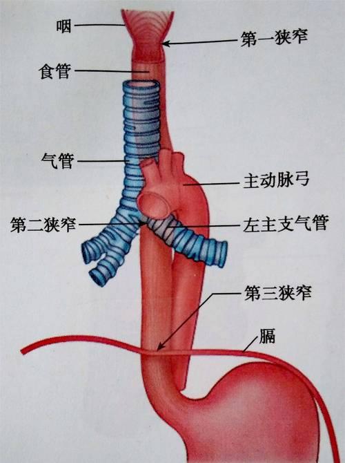 食道窄如针，吞咽难上难，自嘲妙计笑谈间