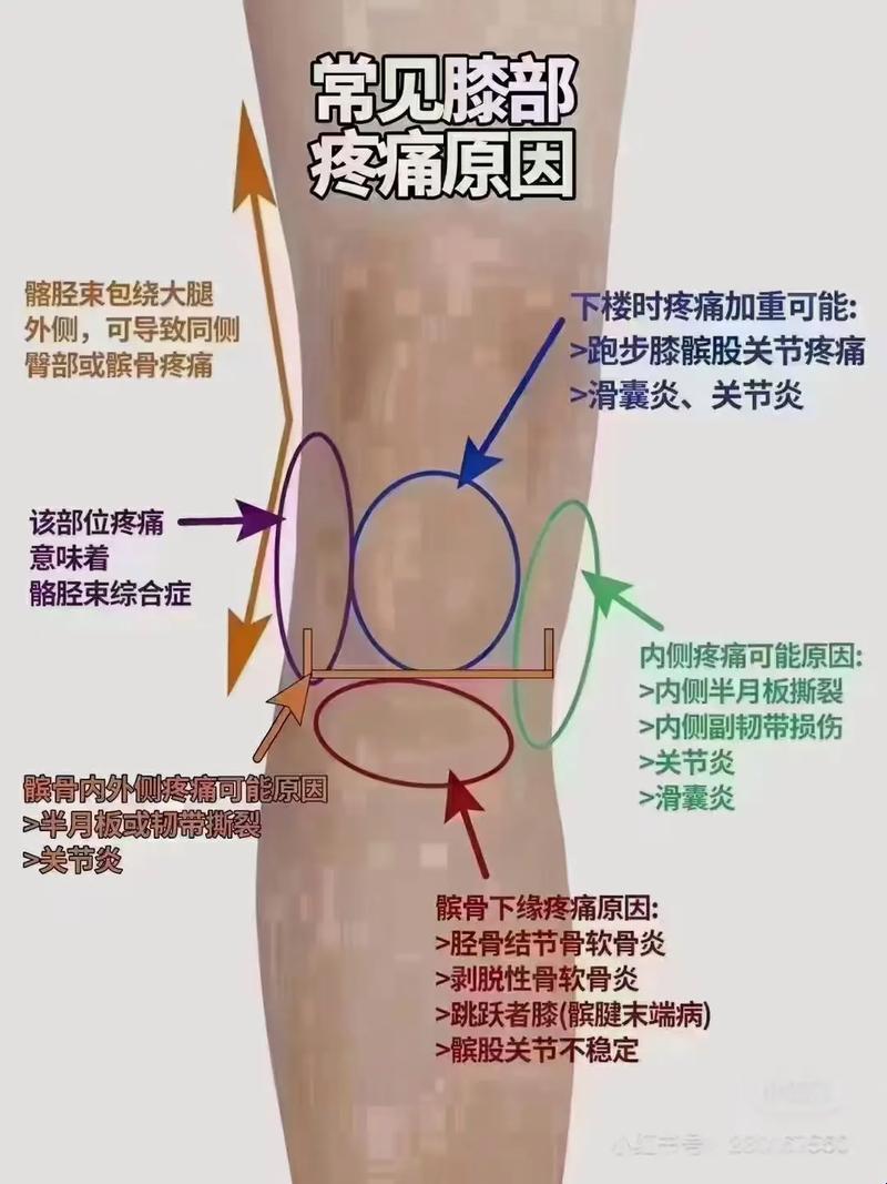 腿疼界的奇葩说：缺钙的脚趾头能顶破天